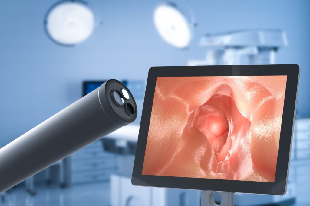 Preparing for a colonoscopy in connecticut|Preparing for a colonoscopy in connecticut