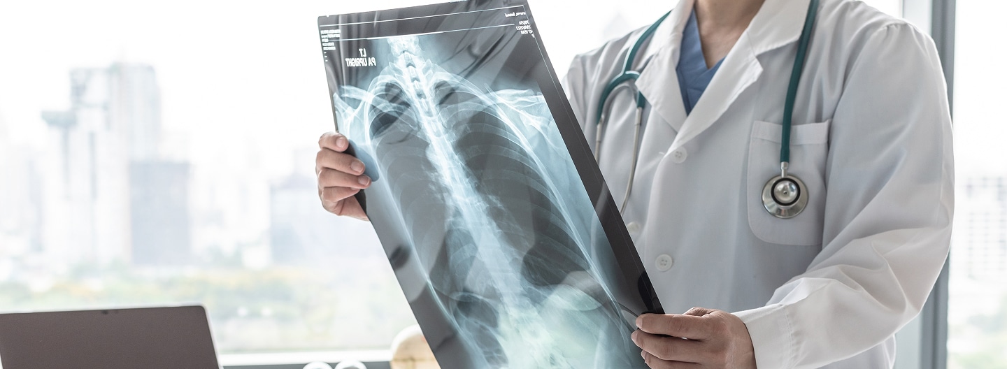 COPD-image