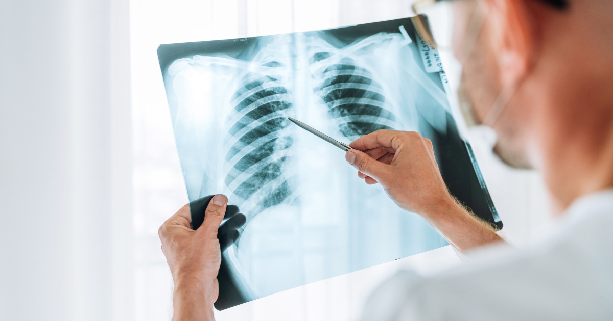 what is a pulmonologist