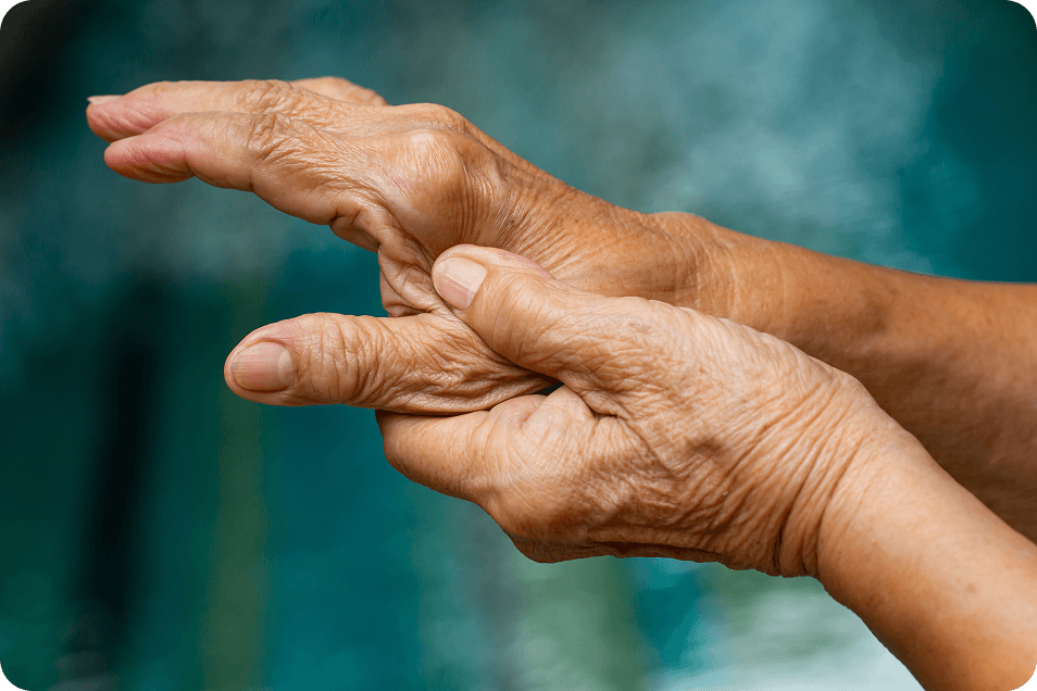 Rheumatoid Arthritis