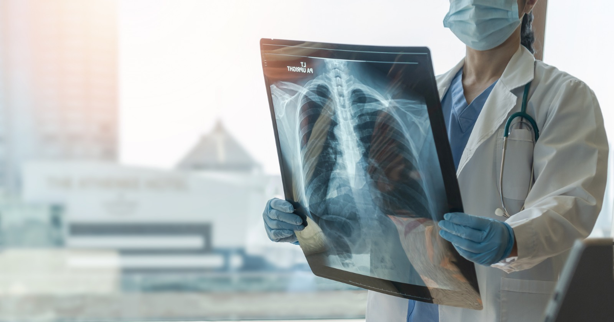 pulmonary fibrosis symptoms